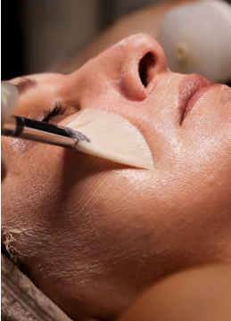 chemical peels
