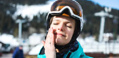 high altitude skin stress